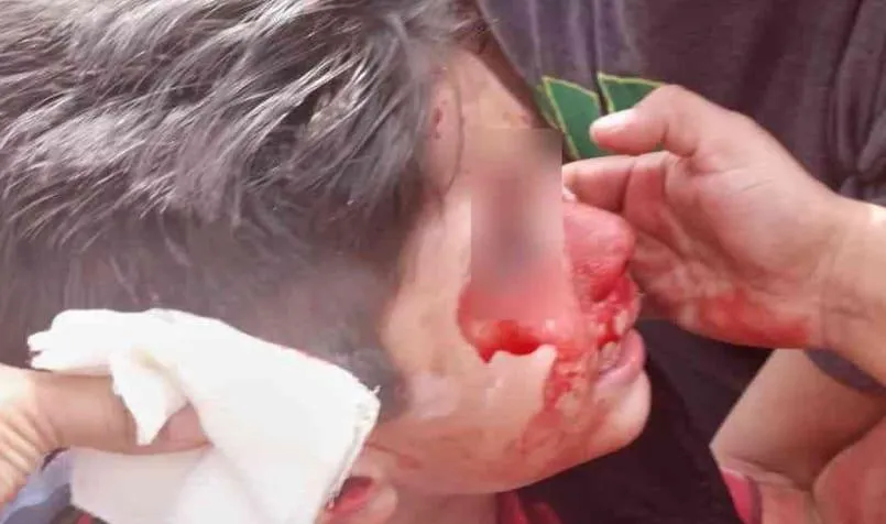 multimedia.normal.9bdc792b41b3a0ea.cGl0YnVsbGxfbm9ybWFsLmpwZw==